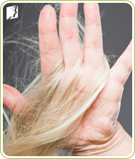 Rụng tóc 1 Rụng tóc 1