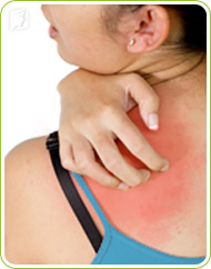 Vấn đề về da 1 Vấn đề về da 1