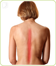 Loãng xương 1 Loãng xương 1